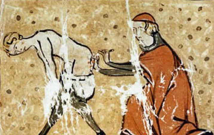 лечение геморроя в средние века